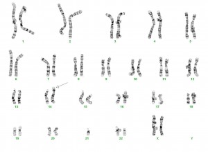Chromosomenanalysen - allgemeine Informationen